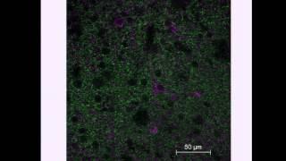 R. Mark Wightman: Electrochemical  Monitoring of Neurotransmitters and Metabolites