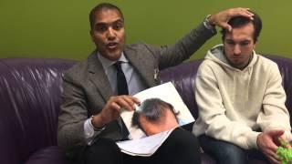 FUE Hair Transplant Repair  8 months after by Dr William Yates