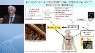 Amyloidosis: Past, present, and future