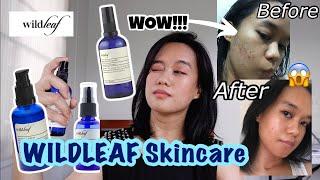 IT WORKS! ONE-MONTH IMPROVEMENT // Wildleaf Skincare Review - For Oily Sensitive Acne Prone Skin