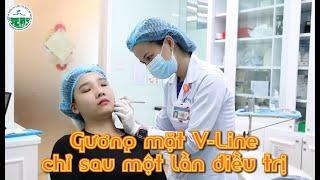GƯƠNG MẶT V-LINE CHỈ SAU MỘT LẦN ĐIỀU TRỊ|| Bệnh viện Da Liễu TP.HCM