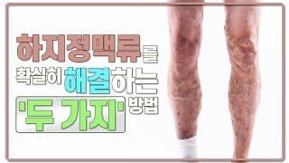 하지정맥류 있으면 '이 병'도 걸릴 수 있습니다. - 전 하버드 대학병원 내과의사 - 김병재 박사