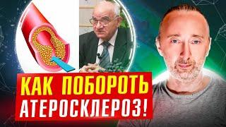 Профессор Исаев: Как не допустить атеросклероз и избавиться от него на 100%?