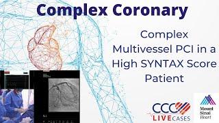 Complex Multivessel PCI in a High SYNTAX Score Patient