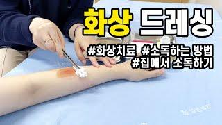 화상 드레싱, 화상치료, 화상 입었을 때 집에서 소독하는 방법 ‍️🩹