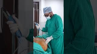 Liposuction surgery before and after results | Dezire Clinic #drprashantyadav #shorts #shortvideo