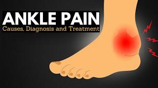 Ankle Pain Survival Guide: Walking Comfortably Through Causes and Treatments