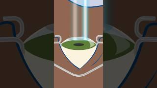 How does PRK surgery work to correct eyesight? #shorts