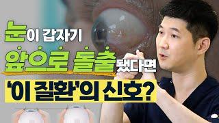 눈이 앞으로 돌출되는 안구돌출, 다양한 원인부터 치료법까지! - 솔직한 안과 #16