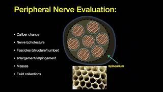 Dr. Jeimylo de Castro talks about MSK ultrasound of the upper extremity peripheral nerves