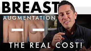 What is the real cost of a Breast Augmentation?