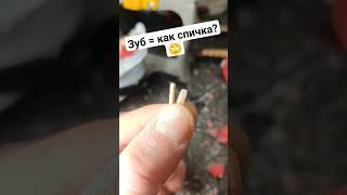 Съёмные БЕЗ нёба! #съёмныепротезы #безнёбасъёмныепротезы #съёмныезубныепротезы #зубныепротезы