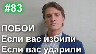 #83 Если Вас избили или ударили. Судимость за побои, нанесение легкого вреда. 115 УК, 116 УК