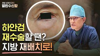 하안검재수술한다면, 요즘엔 지방재배치가 관건!