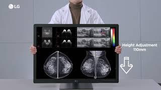 LG Medical Display Monitor Installation