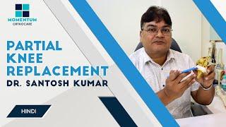 Everything You Need to Know About Partial Knee Replacement - Dr Santosh Kumar [ in Hindi ]