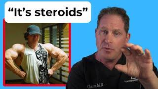 Doctor Reacts to Sam Sulek:Steroid Recovery Plan