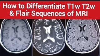 How to Differentiate T1w T2w and Flair Sequences of MRI | Easy to learn in just 2 mint