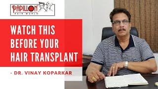 WATCH THIS before YOUR Hair Transplant | Hair Transplant Risks