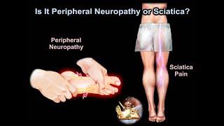 Is It Peripheral Neuropathy or Sciatica - Everything You Need To Know - Dr. Nabil Ebraheim