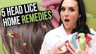 Top 5 Home Remedies for Head Lice Removal! WATCH BEFORE YOU TRY!