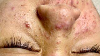 Satisfying video with Chung Vo Spa | 252