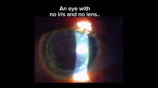 An eye reconstructed