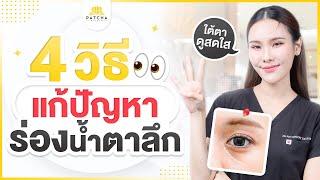 4 วิธีแก้ไขปัญหาร่องน้ำตาลึก