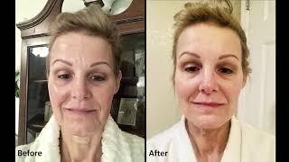 Anti Aging Product Benefits Before and After Usage | Nuovaluce Beauty