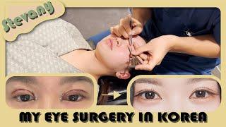 I GOT DOUBLE EYELID SURGERY IN KOREA! I Braun Plastic Surgery