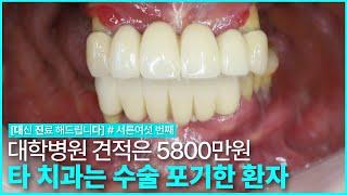 [대진다] 대학병원은 5800만원, 타 치과는 수술 포기한 환자│임플란트, 당일 임플란트, 뼈이식, 상악동거상술│#서른여섯 번째