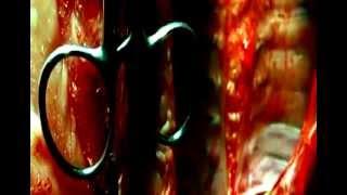 venetian snares - szamar madar