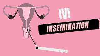 How to do at Home IVI Insemination