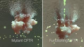 Cystic Fibrosis Mechanism and Treatment | HHMI BioInteractive Video