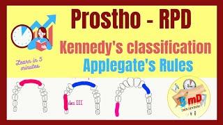 KENNEDY'S CLASSIFICATION | RPD | PROSTHODONTICS