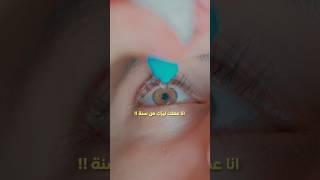 تجربتي مع الليزك بعد سنة !!️