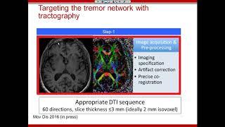 Webinar: Vibhor Krishna - Tractography-based Targeting for Functional Neurosurgery