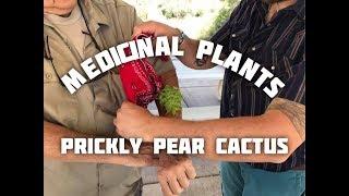 Treating Sunburns In the Field (Prickly Pear Cactus)