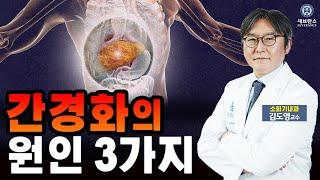 간경화 원인 3가지 | 소화기내과 김도영 교수